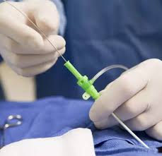 Arezzo – Siena – Rottura Aneurisma Ramo Aorta risolto senza Trasfusioni